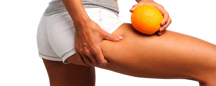 Як позбутися целюліту?