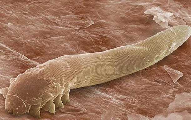 Обережно, підшкірні кліщі Demodex!