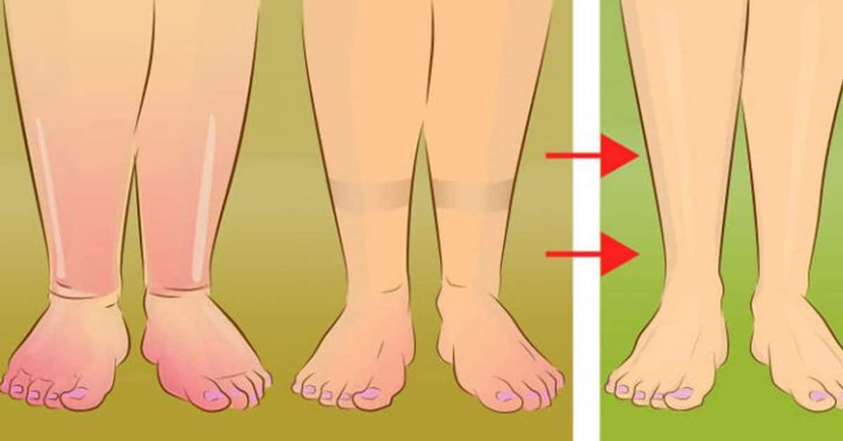 Продукти, які допоможуть вивести зайву рідину з організму