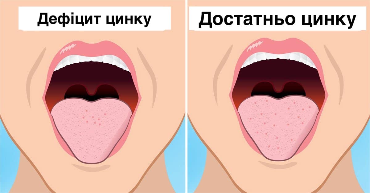 Організм потребує цинку щодня! Основні ознаки його нестачі, які послаблюють організм