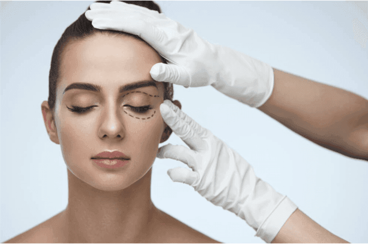 Что такое блефаропластика и кому она подойдет