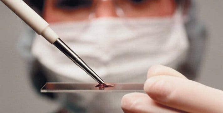 Загальний аналіз крові: 9 основних показників, які розкажуть все про ваше здоров’я!