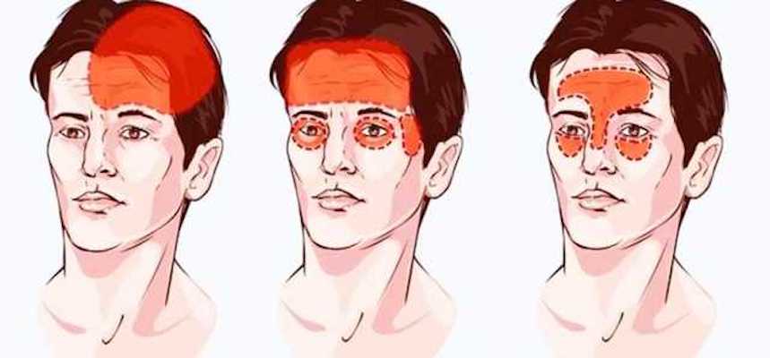 Повинен знати кожен! Все про головний біль (причини, види головного болю). Як лікувати та що приймати?!